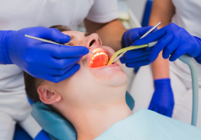 Tooth Extraction